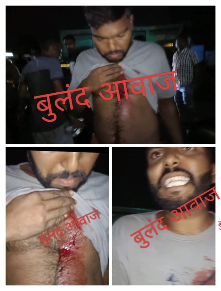 टीपी नगर शराब दूकान में हुई चाकूबाजी की घटना, वरदात में एक युवक घायल